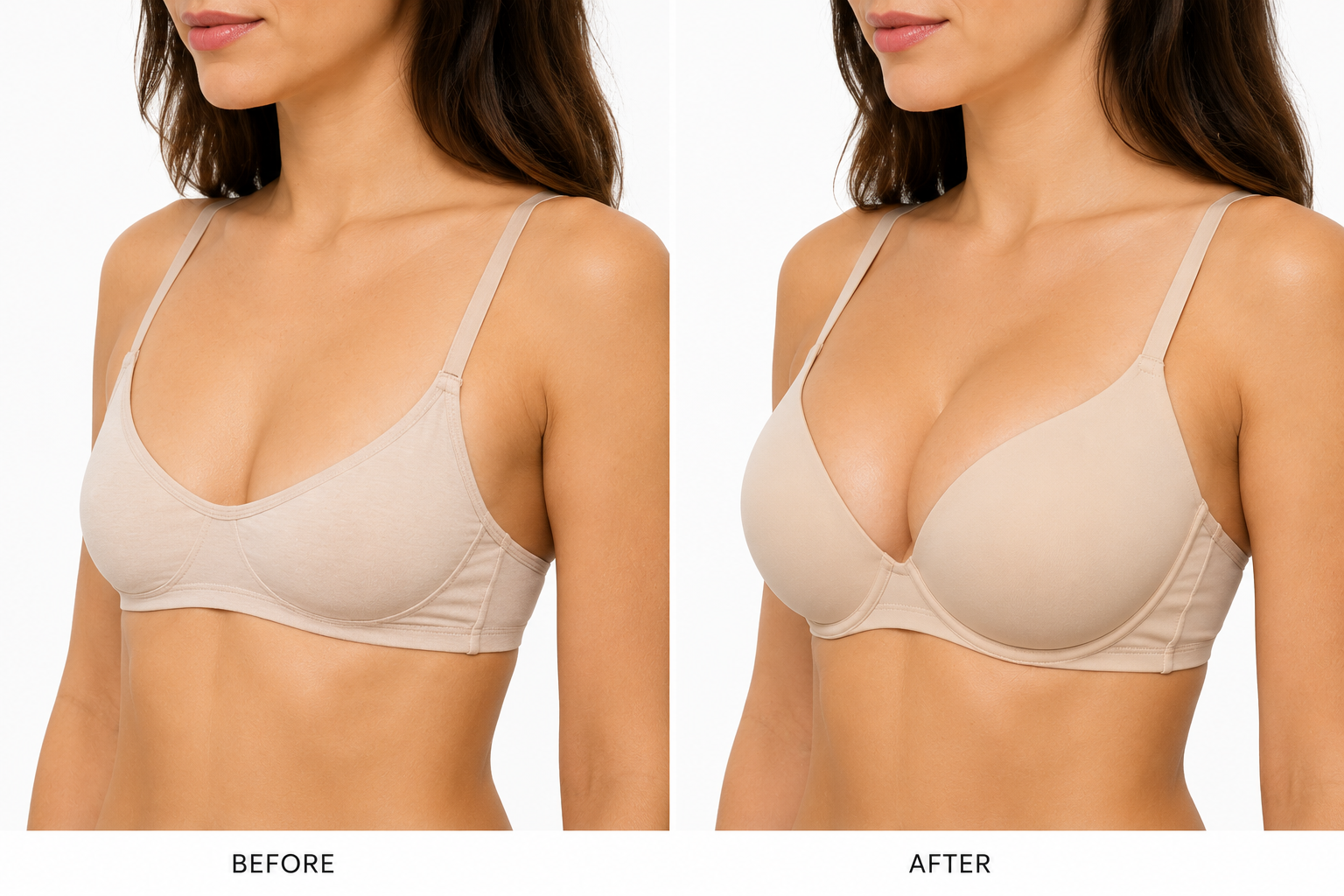 Breast augmentation before and after — patient consent given